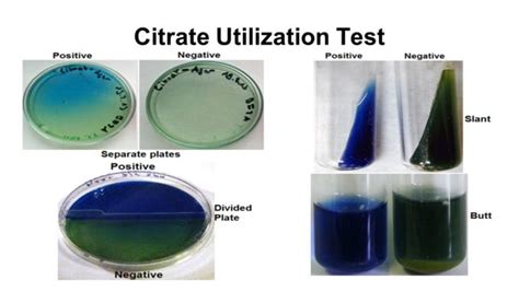 citrate utilization test|Citrate utilization test: objective, principle, procedure .